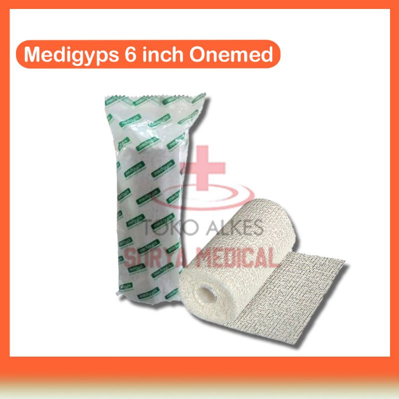 Original Gyps Patah Tulang - Perban Gips 6inch - Medigyps Onemed Exp Baru