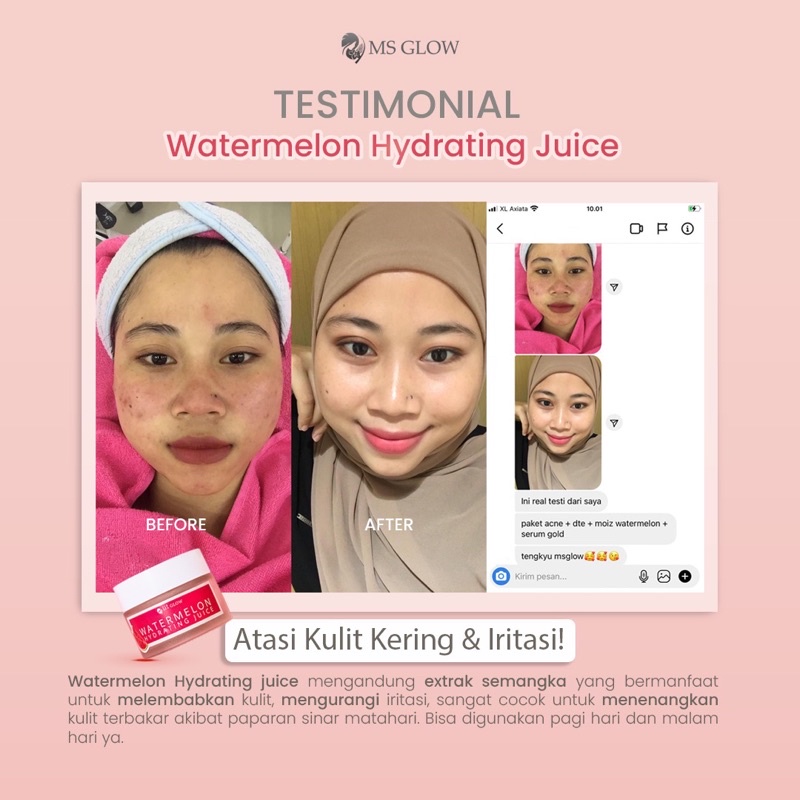 WATERMELON JUICE MSGLOW MELEMBABKAN 24 JAM