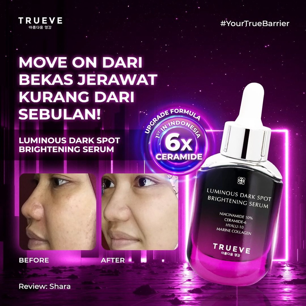 Truve NIACINAMIDE 10% Brightening Serum Penghilang Flek Hitam dan Bekas Jerawat Official Shop