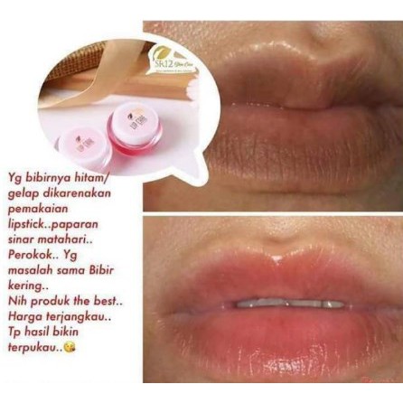 Lip Care SR12