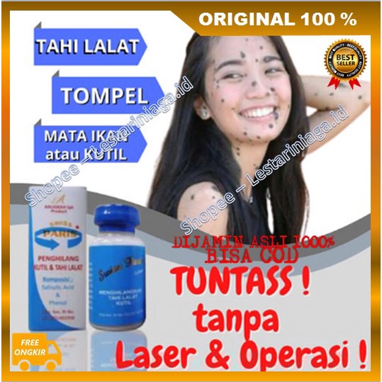 [BISA COD] BELI 2 GRATIS 1 Salep Kutilang Salep Tahi Lalat, Kutil & Daging Tumbuh Ampuh ORIGINAL