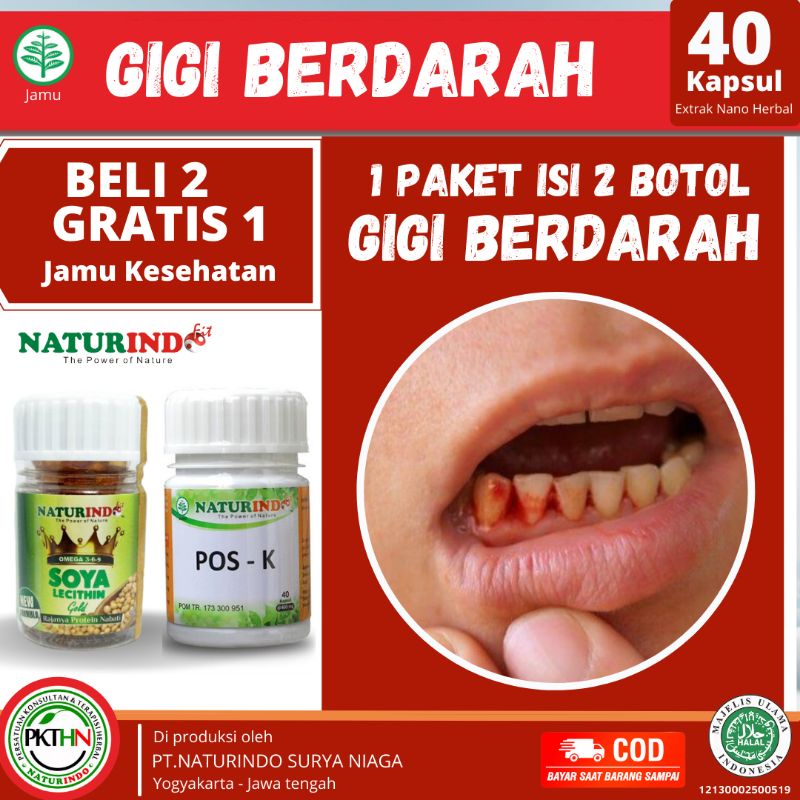 Obat penguat gigi sakit gigi berdarah gigi goyang gigi ompong gusi bengkak gigi dewasa dan anak penguat gigi goyang tua berlubang nutrisi dan kalsium gigi sakit gigi gigi keropos