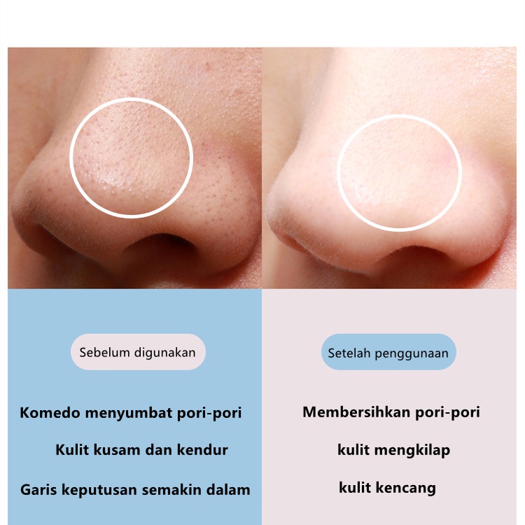 inFace alat pembersih komedo wajah Ultrasonic Ionic elektrik  Pori-Pori Kerut USB Rechargeable Skin Scrubber Wajah Mesin Pengupas Ultrasonik Ion Positif Dan Negatif Peralatan Penghilang Di Hidung Detok Pori Jerawat Pijat Kecantikan Perawatan Kulit Wanita