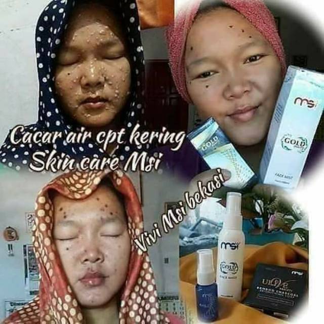 PAKET FLEK HITAM MSI