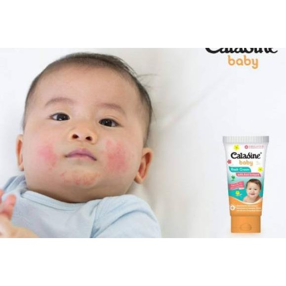caladine baby rash cream