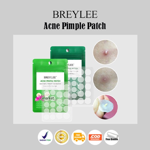 [BPOM] BREYLEE Acne Pimple Patch