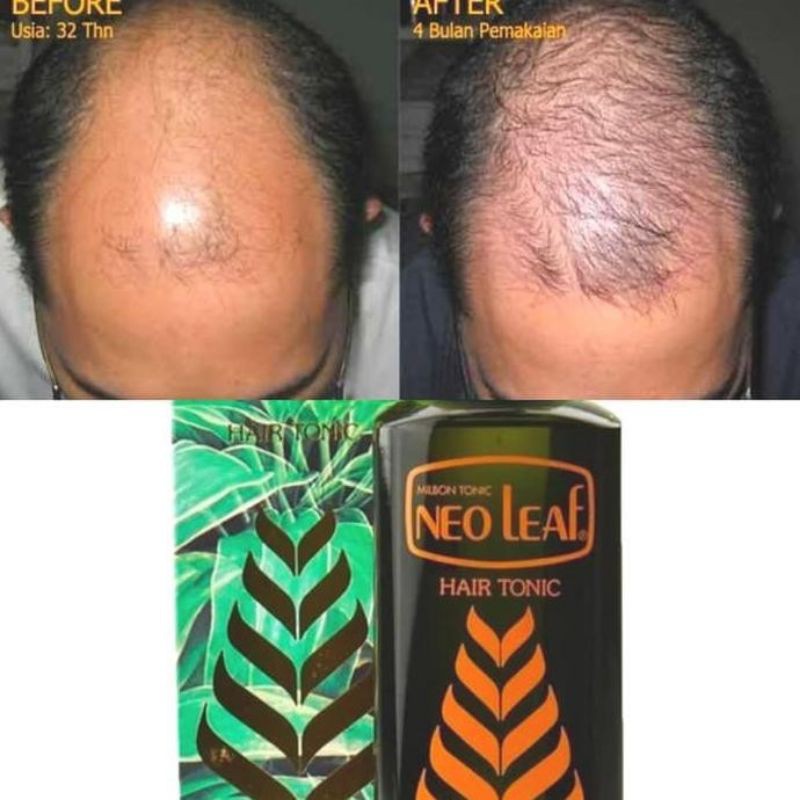 Neo Leaf HairTonic 240ML