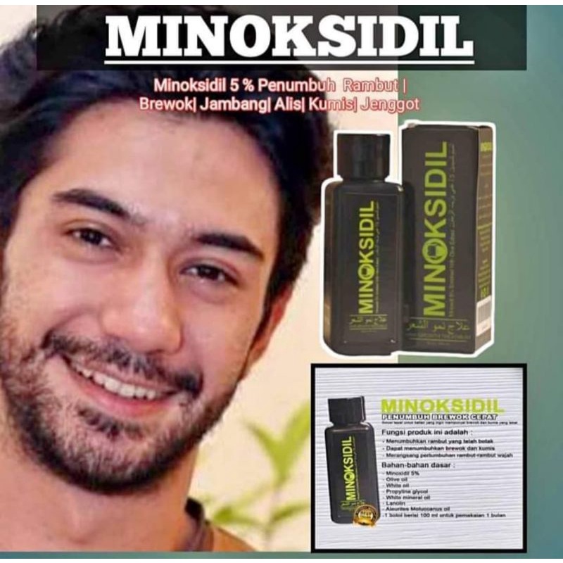 Terlaris Minoksidil Penumbuh Rambut Murah