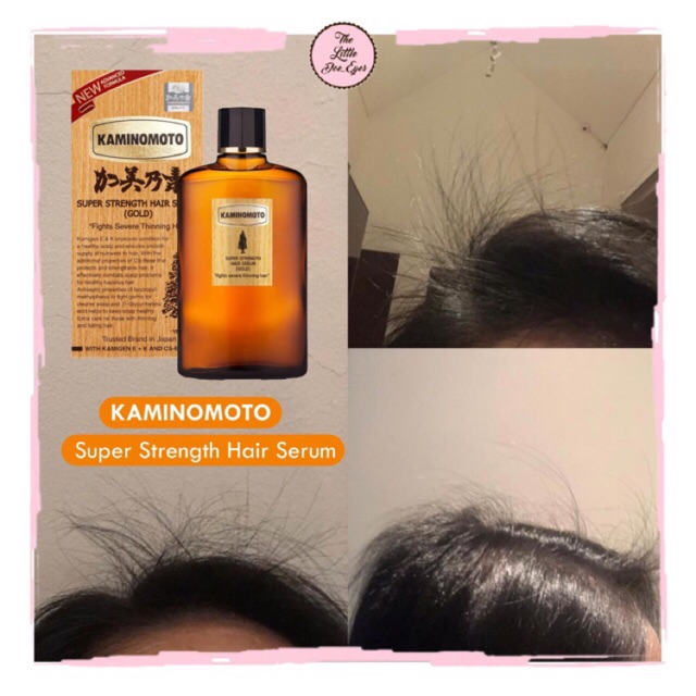 [READY] Kaminomoto Hair Growth Accelerator