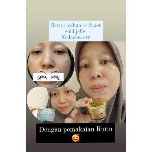 GOLD JELLY kedas beauty-5