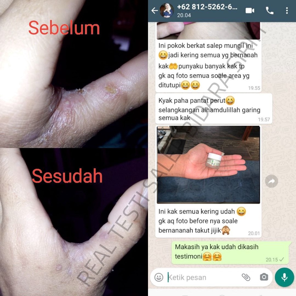 Salep sabun Bidara Sirih saleb gatal ampuh