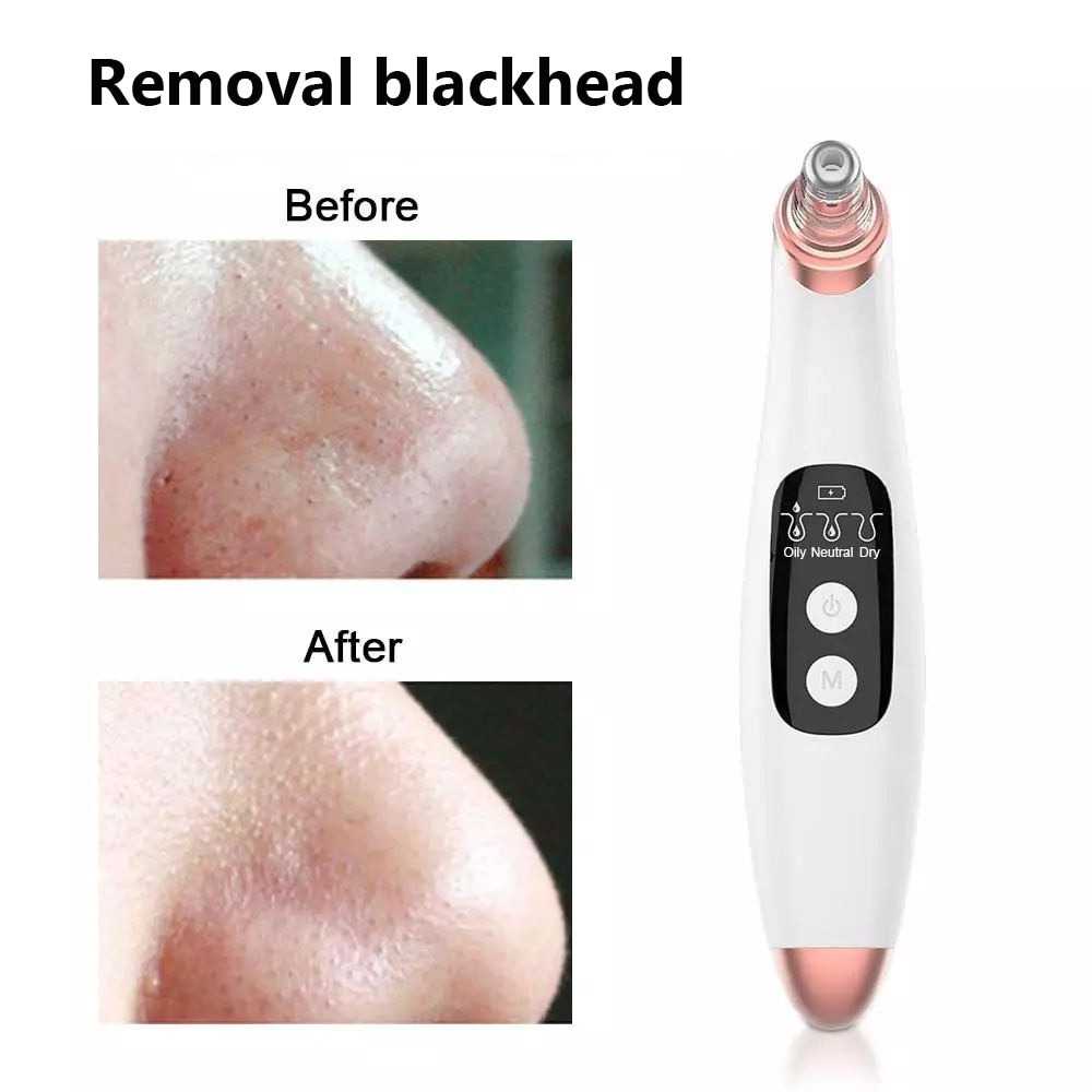 Pembersih Wajah Vacum Penyedot Komedo Elektrik Facial Blackhead Remover Vacuum Suction