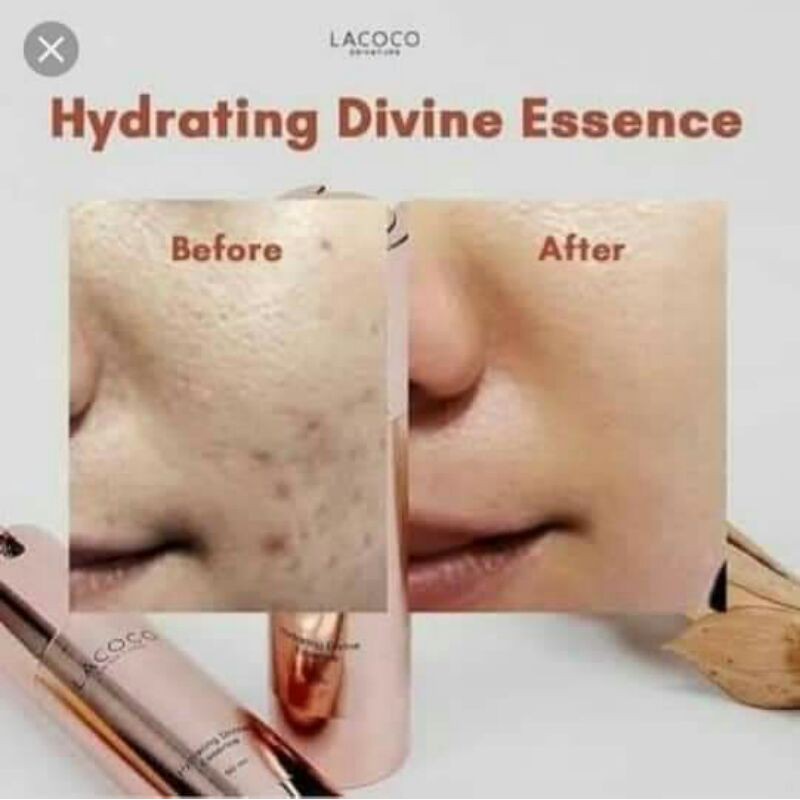 READY...HDE LACOCO NASA(MEMBERSIHKAN BEKAS JERAWAT/BOPENG)