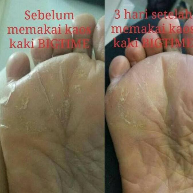 NEW PRODUK BIGTIME KAUS/KAOS KAKI ANAK ANTI BAU / BAKTERI 7 HARI 6 PASANG/BOX