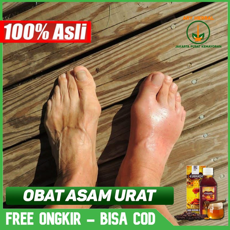 

Obat Asam Urat, Pegal Linu, Sakit Pinggang Linu Herbal Kurmaqu Sari Kurma Di Jakarta Pusat COD