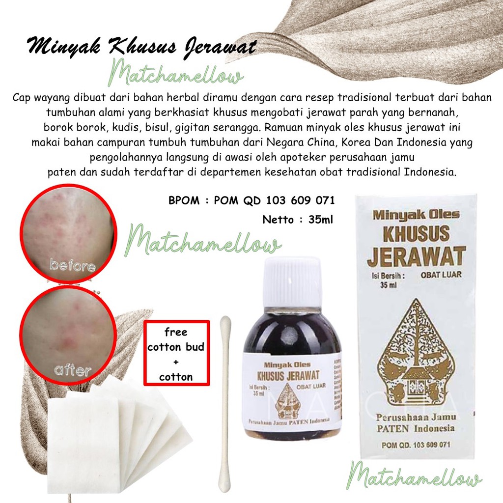 ❄️MATCHA❄️ OBAT JERAWAT WAYANG / minyak oles jerawat