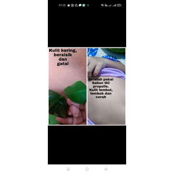 sabun GC propolis dan rice milk