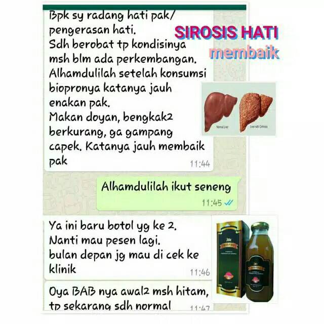 

HERBAL M BIO PRO SOLUSI SIROSIS HATI | LIVER | ASAM LAMBUNG