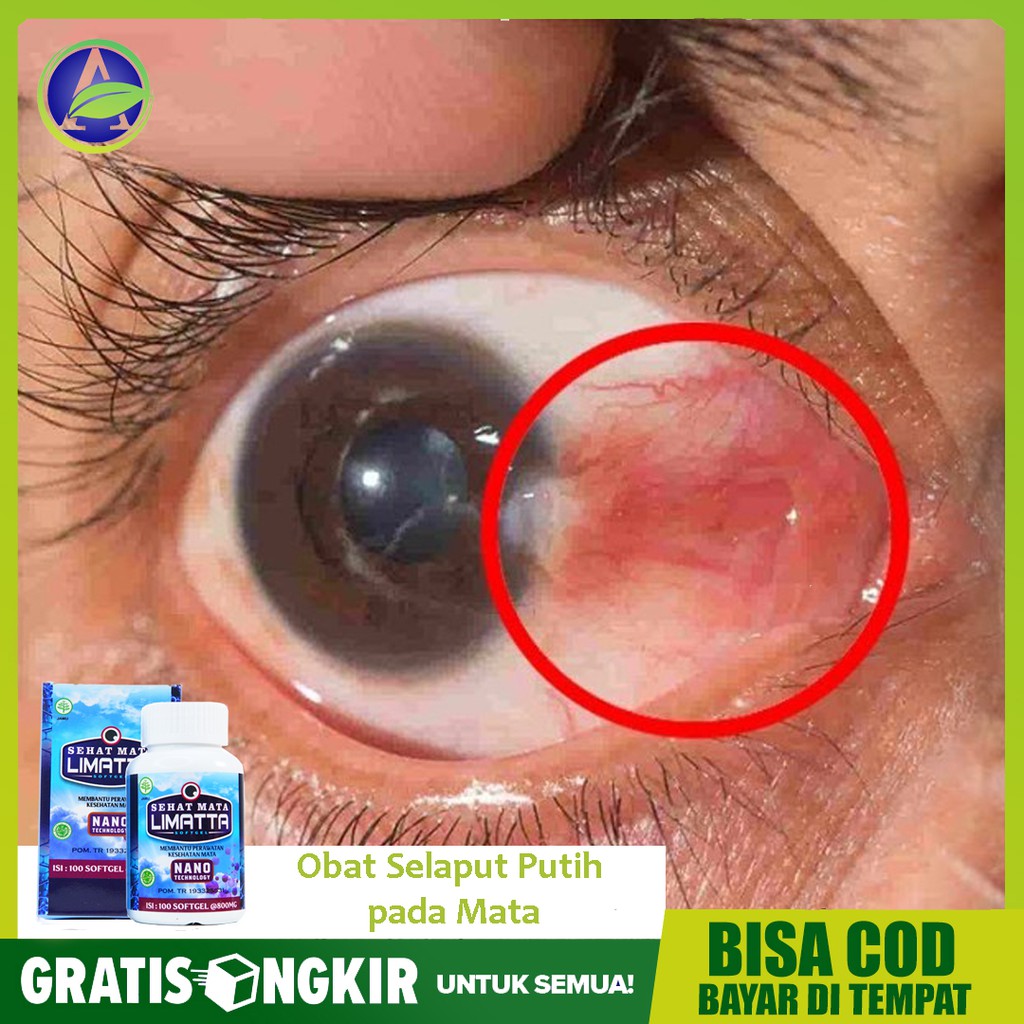 Obat Selaput Putih Pada Mata Lamad Matas Pterygium Herbal Sehat Mata Softgel Asli Bisa Cod Shopee Indonesia