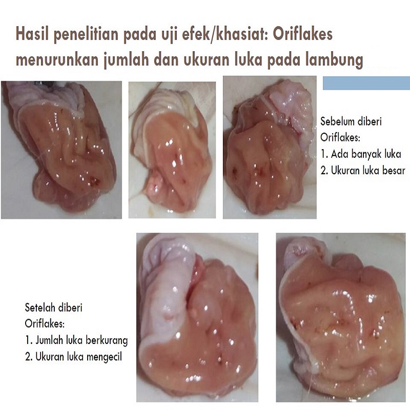 

Flakes Sereal Umbi Garut Asam Lambung Oatmeal Outmeal Sereal Diet Sna Diabetes Maag Gerd Ampuh Bpom