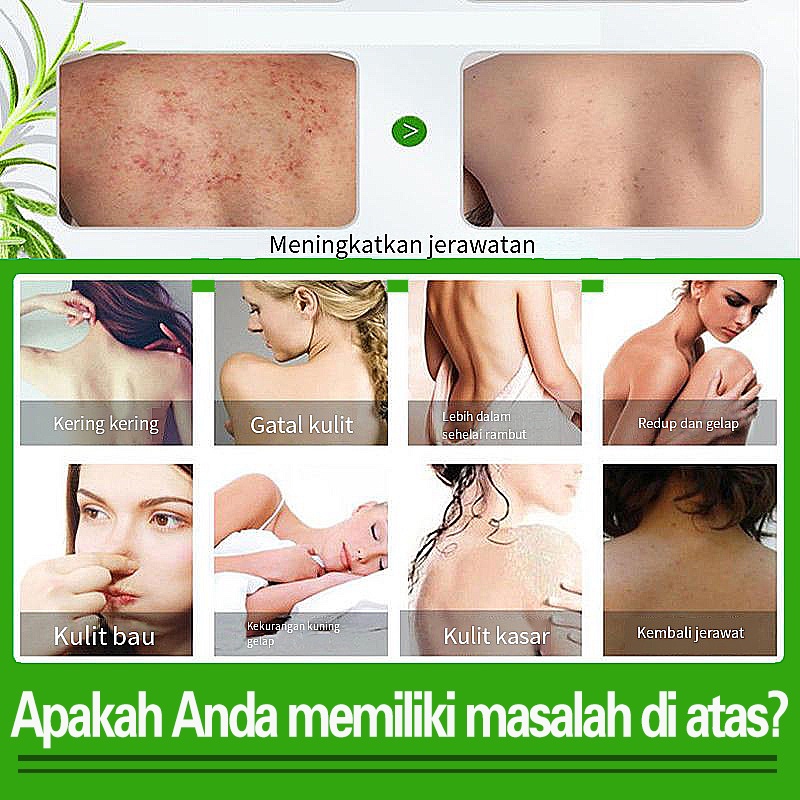 Wormwood Sabun mandi cair anti bakteria Menghilangkan tungau Membersihkan jerawat Anti gatal Body Wash Whitening Solusi Anti Jerawat  Memperbaiki Kulit Mencerahkan 100% herbal Produk Asli