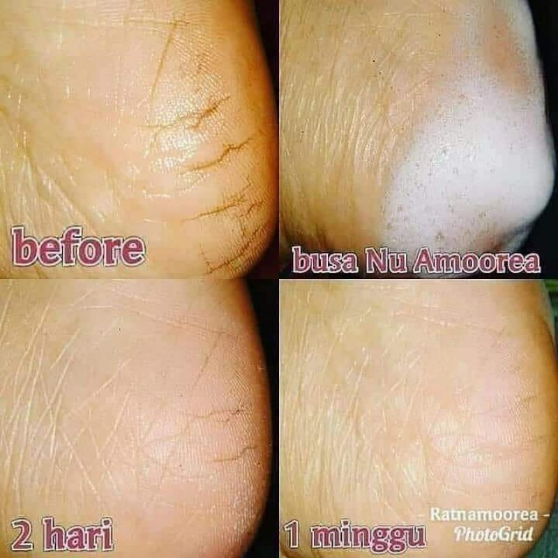 NU amoorea beauty bar & NU amoorea beauty plus