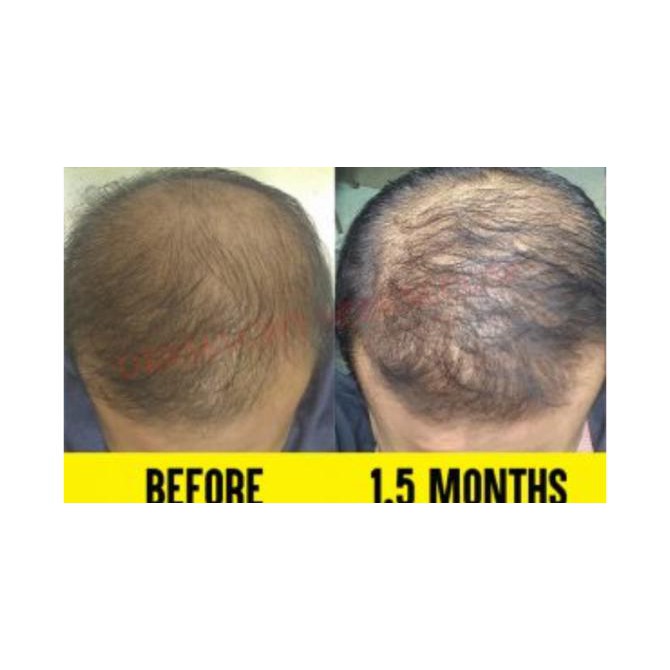 Perawatan Tubuh - Paket Dermagift - Gold