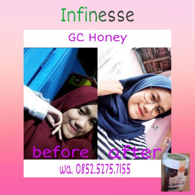 

Gc Honey Infinesse