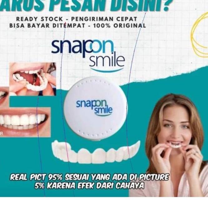 Segera Miliki ✩ Snap On Smile Gigi Palsu 1 Set Atas Bawah - Gigi Palsu Silikon 100% Ori