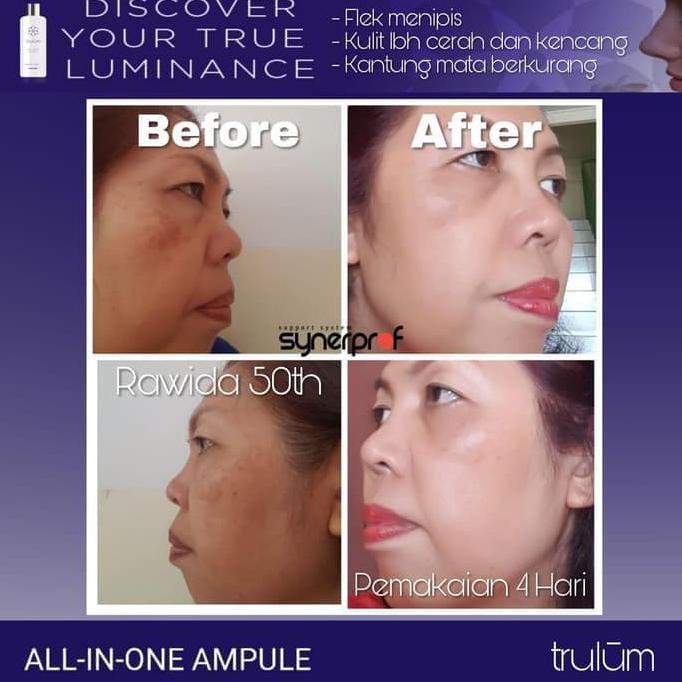 Termurah Atasi Kulit Wajah Kering Keriput | Trulum Jadikan Kulit Wajah