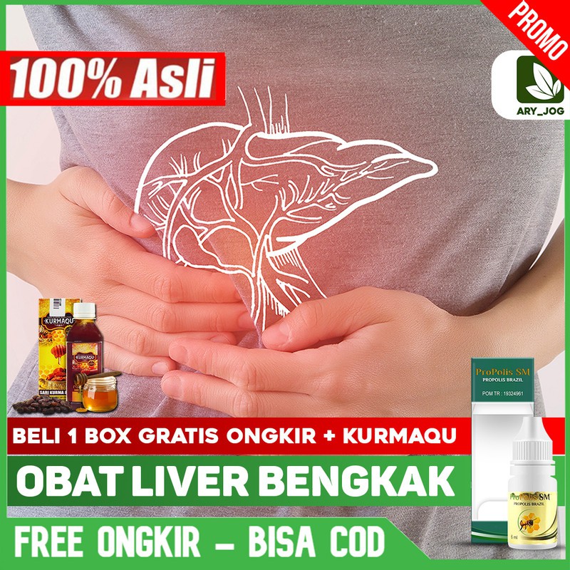 Obat Liver Bengkak, Hati Liver, Hepatitis, A B C Sirosis Herbal PROPOLIS SM Yogyakarta Bisa COD