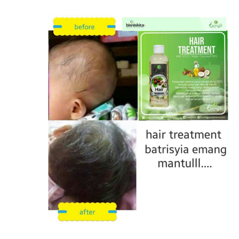 Baby hair treatment/ Penumbuh rambut anak/melebatkan rambut/menghitamkan rambut bahan alami bpom