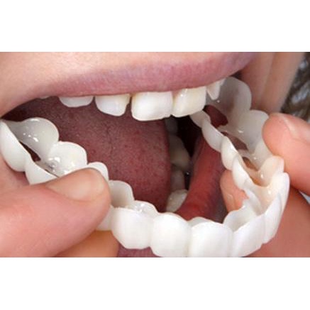 Limited -  Snap On Smile 100% ORIGINAL Authentic / Snap n Smile Gigi Palsu 케