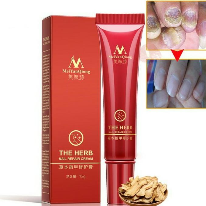 READY STOCK kuku / perawatan kuku / cream jamur kuku meiyanqiong / obat kuku