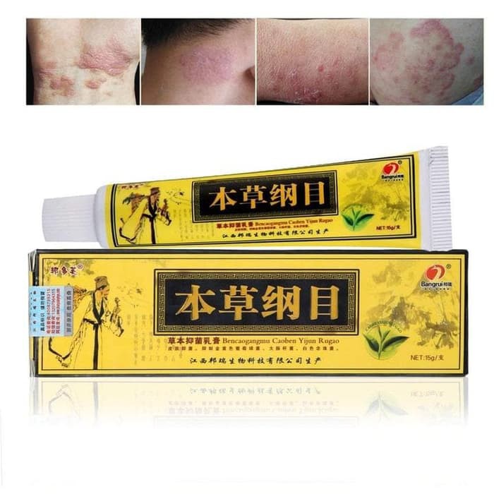 Herbal Ampuh Psoriasis Jerawat dan Eksim Krim Herbal Alami