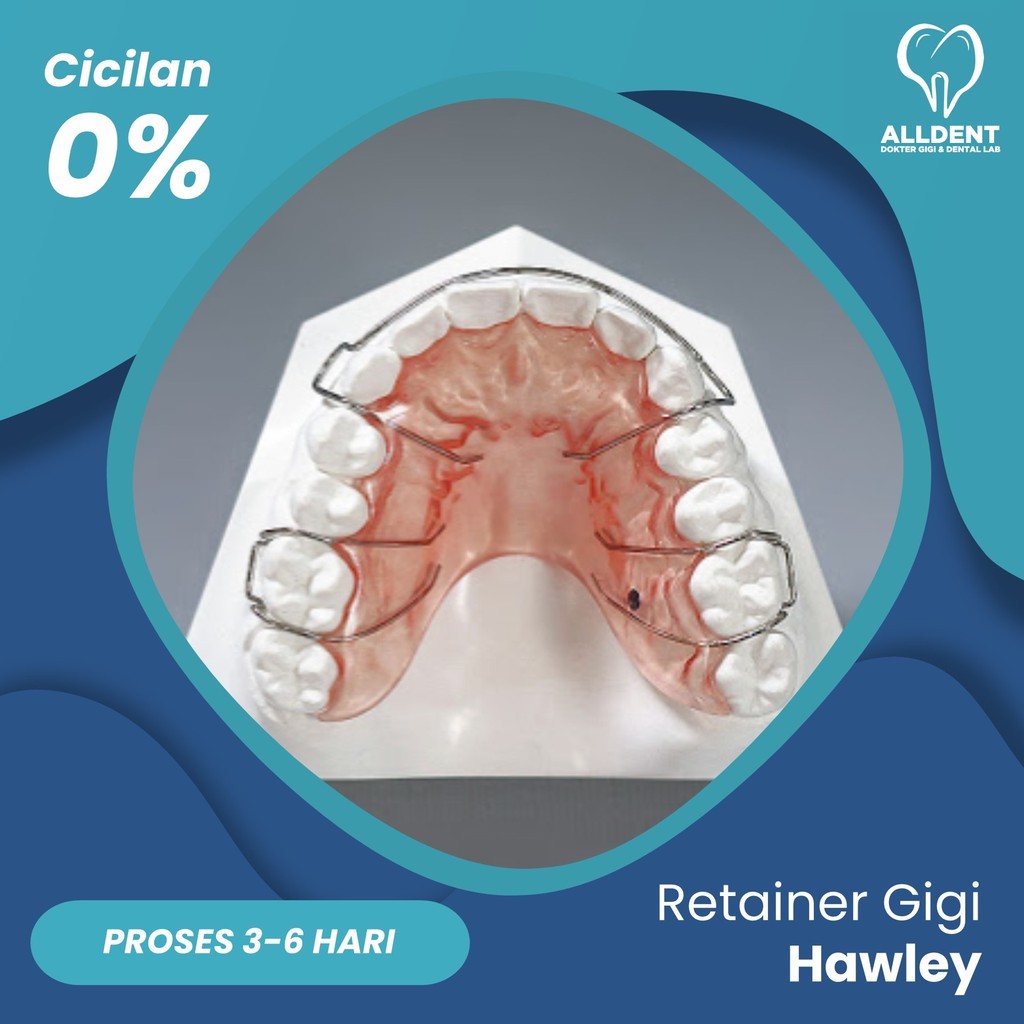 Retainer Gigi Hawley