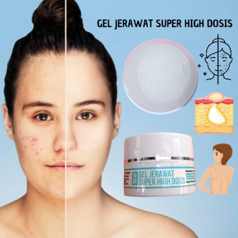 GEL JERAWAT SUPER HIGH DOSIS 10GR