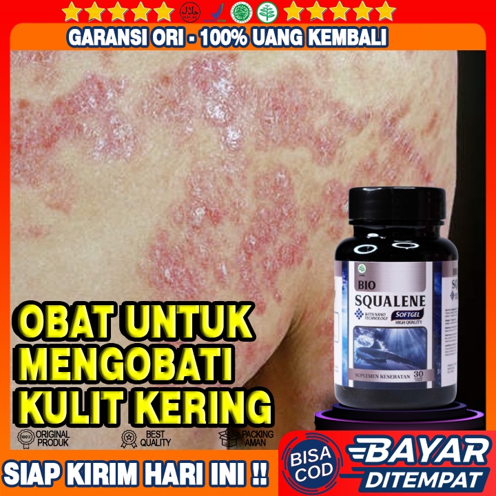 Obat Kulit Kering - Obat Kulit Bersisik - Obat Kulit Kering Dan Pecah - Pecah - Kulit Kering Menebal