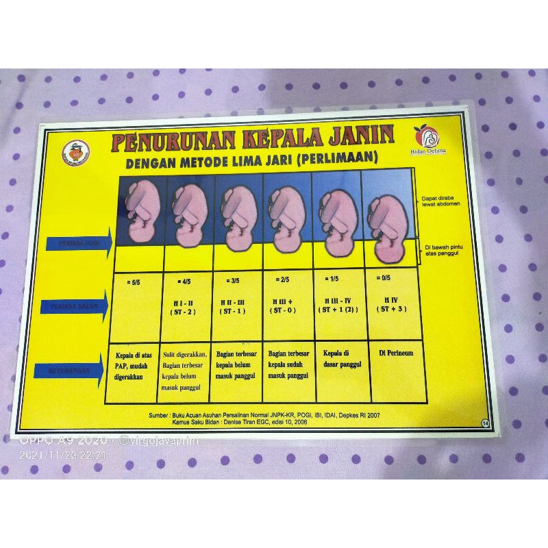 

(NO 14) Poster penurunan kepala janin