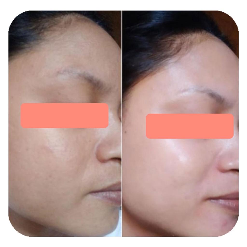 ADLEEVA BY ADEEVA Paket Basic Whitening Series Skincare Original Glowing-2