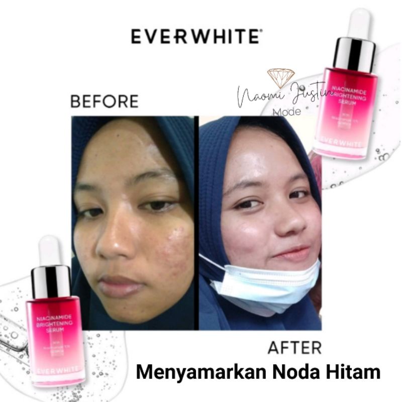 C Everwhite Niacinamide Brightening Serum ( Untuk Noda Hitam)