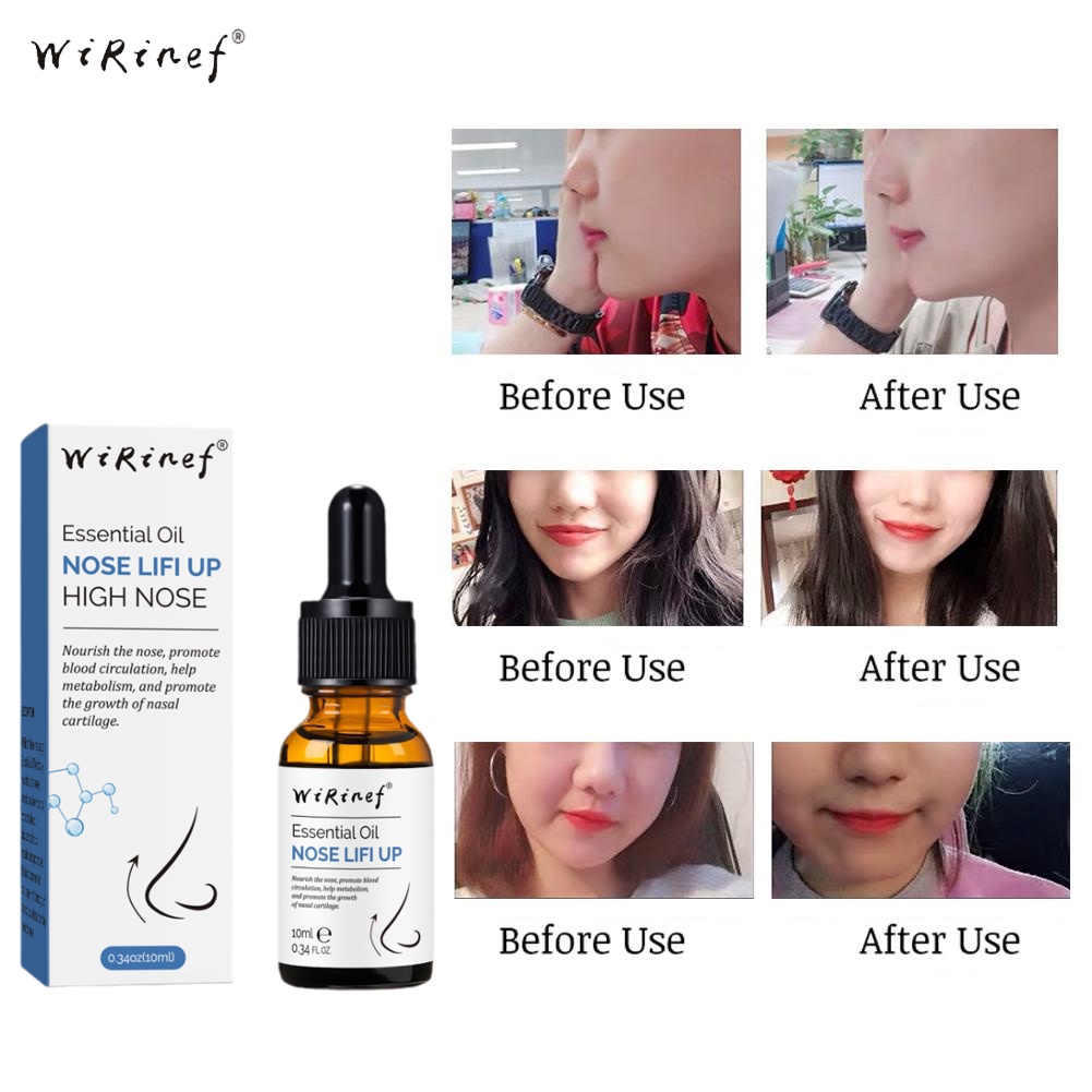 alat hidung pemancung hidung alat pemancung hidung 10ml Nose lift up essential oil Hidung Cepat Memancungkan Memancungkan Hidung Secara Alami dan Aman