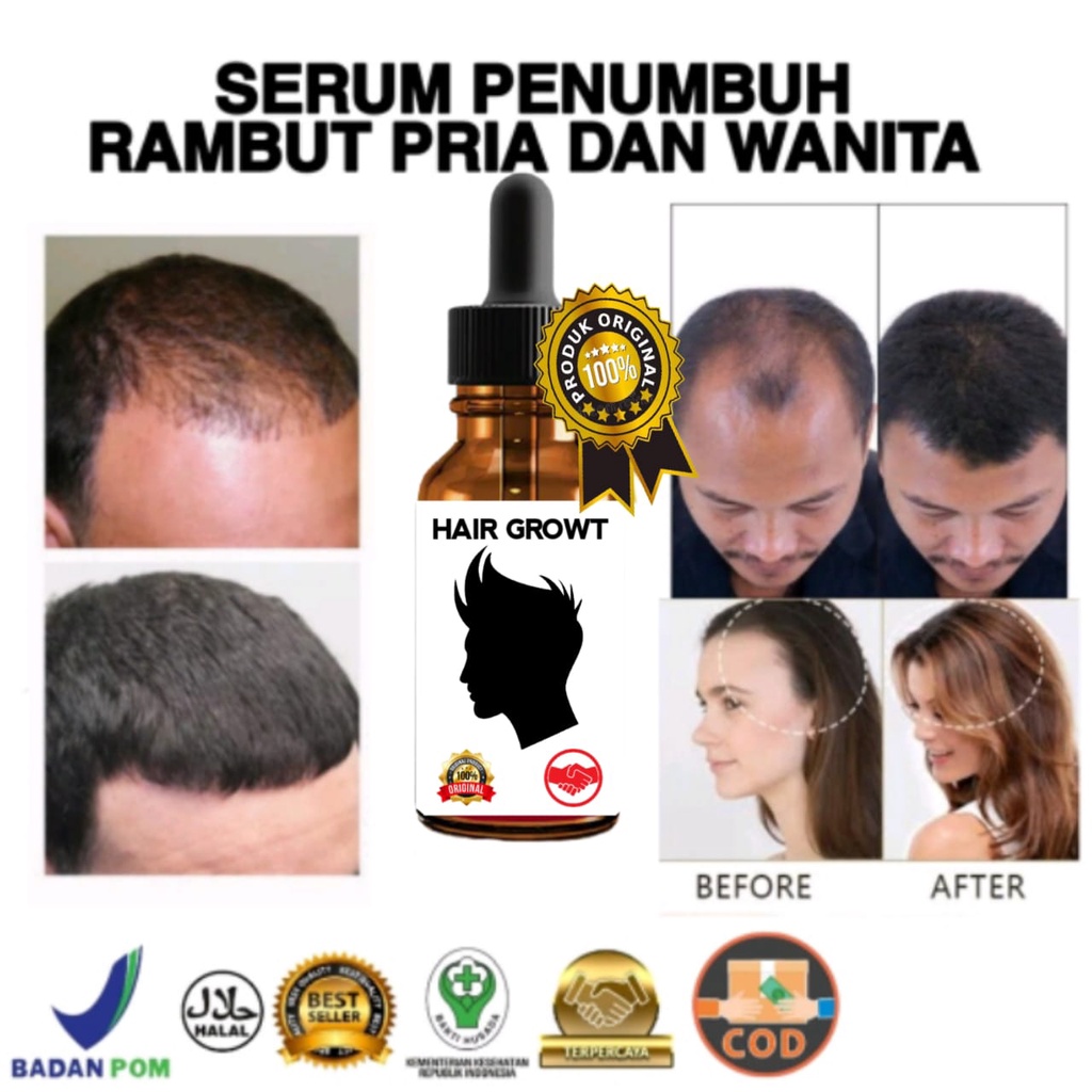 Serum penumbuh rambut / penumbuh rambut secara cepat / vitamin rambut rontok / obat penumbuh rambut / perawatan rambut wanita / vitamin rambut pria/PERMANEN