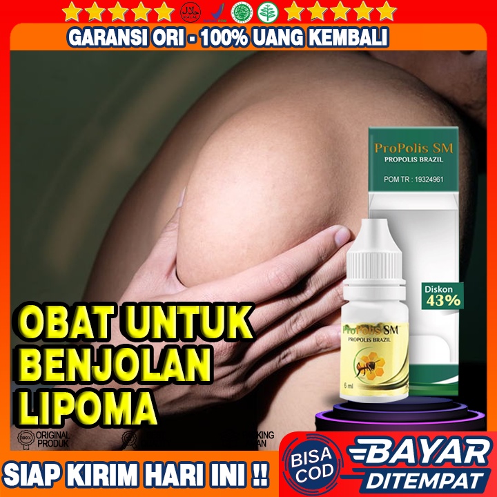 Obat Untuk Menghilangkan Benjolan Lipoma, Benjolan Lipoma di Leher, Benjolan Lipoma di Dagu, Benjola