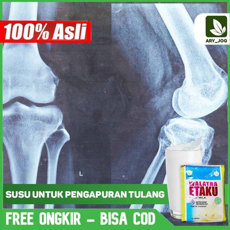 

Susu Untuk Pengapuran Tulang - Tulang Keropos - Patah Tulang Walatra Susu Kambing Di Yogyakarta