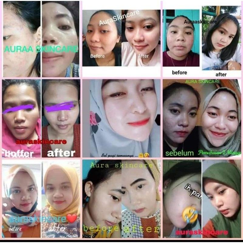 aura skincare