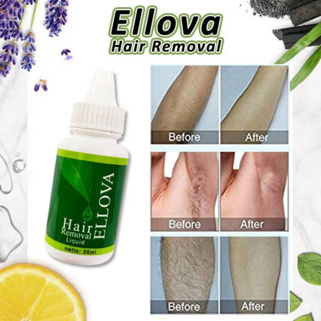 Hair Removal Wax Perontok Bulu Ellova Obat Penghilang Rambut Jenggot Permanen Di Apotik Kimia Farma Shopee Indonesia