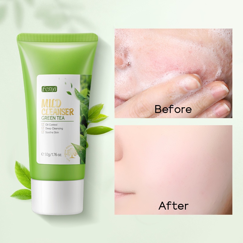 Fenyi Green Tea Toner Set Perawatan Kulit Memutihkan Wajah Serum Mengecilkan Pori-pori Menghilangkan Jerawat 3 Pcs
