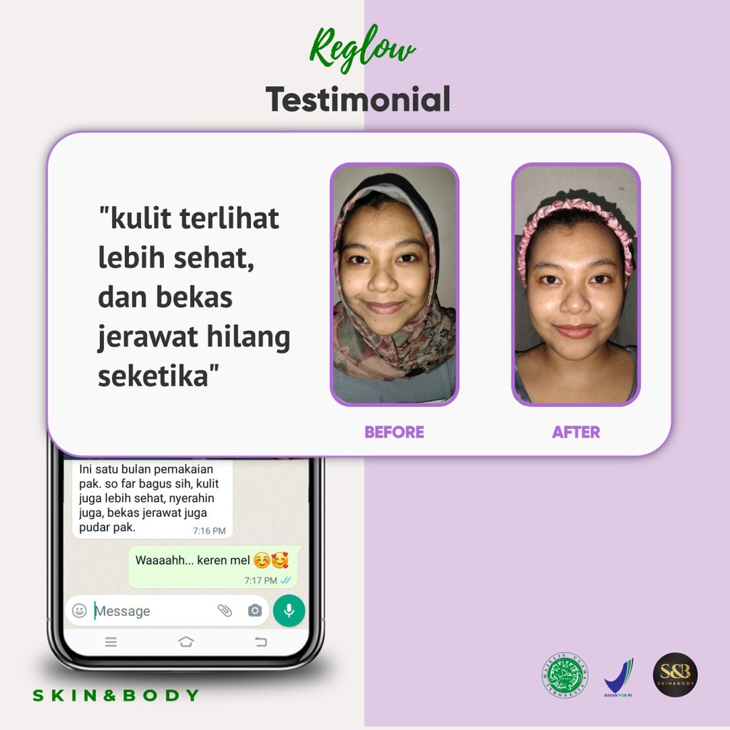 REGLOW Paket Skincare Original Asli | Perawatan Kecantikan Wajah Glowing | Glow Skin Treatment | Atasi Muka Jerawat Flek Hitam Milia Kusam | Skin Care BPOM Halal MUI | Sunscreen Whitening Anti-Aging | Aman Bumil Busui-1