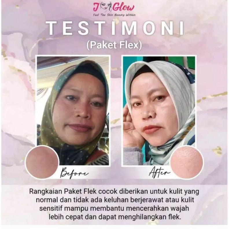 Jglow Paket Flek Pelling Serum(Ampuh memudarkan Flek Hitam)Paket Spot Exfoliating Serum